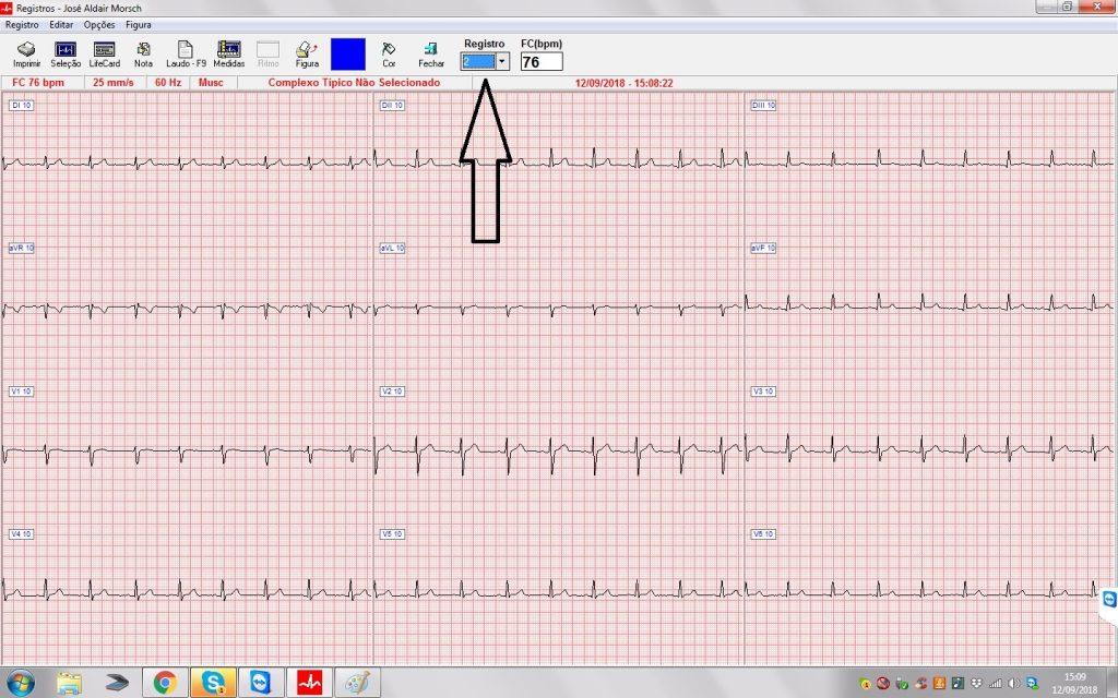 escolha dos registros de ecg no wincardio