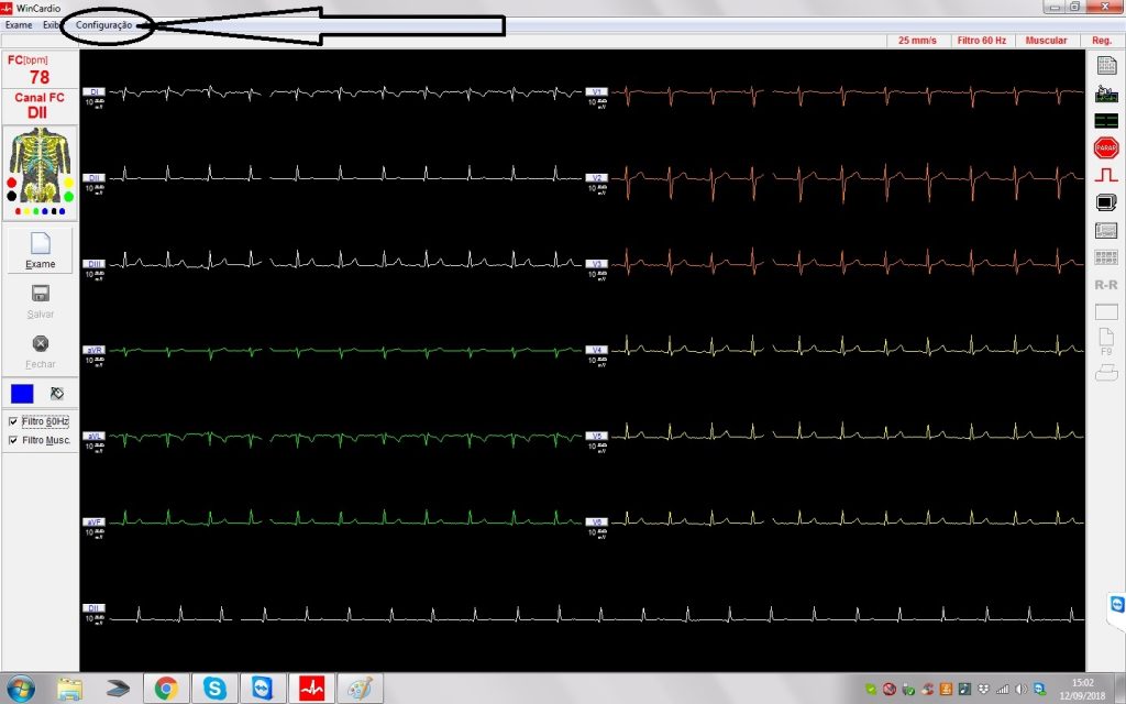 wincardio
