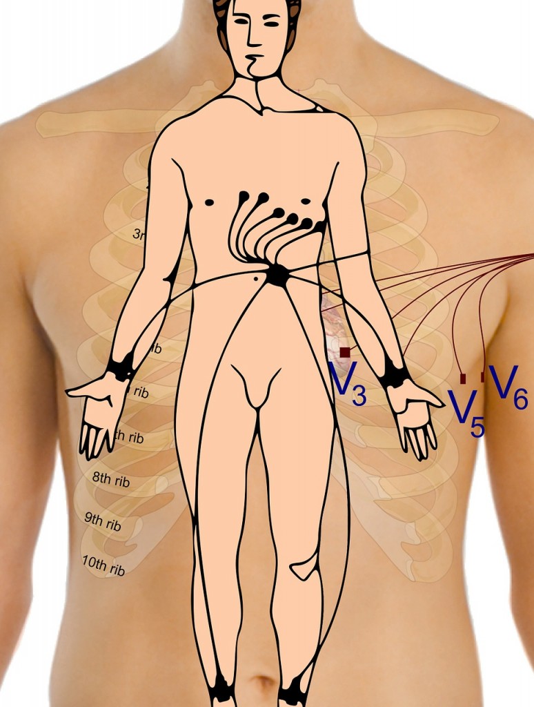 curso de eletrocardiograma