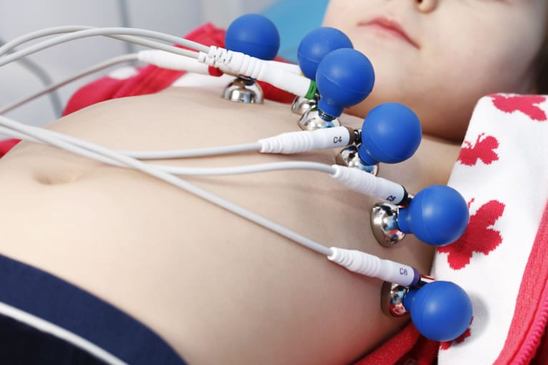 Classificação e localização dos eletrodos do eletrocardiograma?