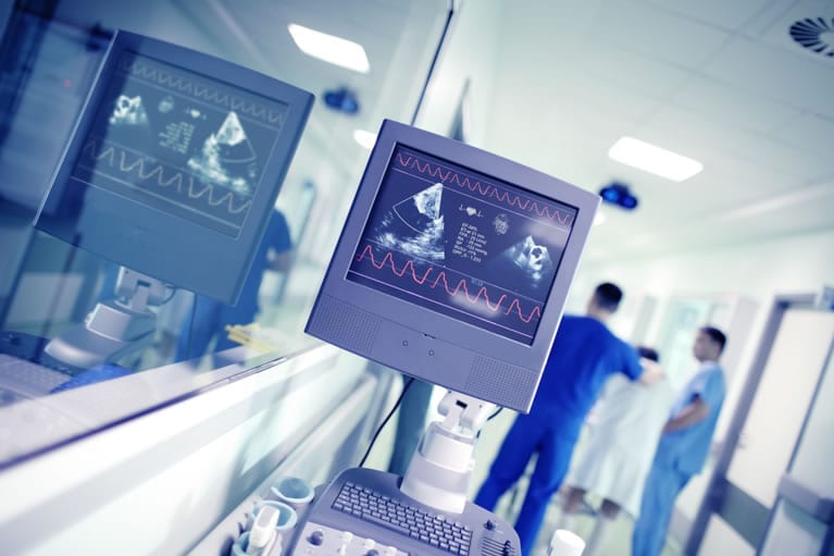 Resultados do ecodopplercardiograma