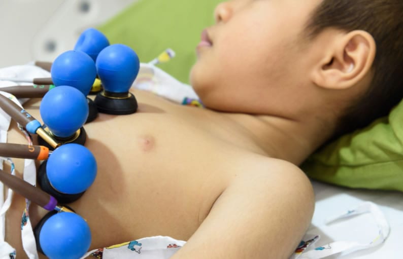 Resultados do ECG Pediátrico