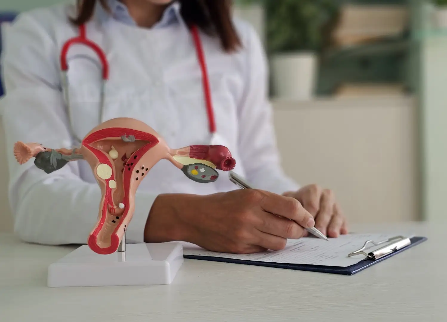 Mulher com endometriose pode engravidar