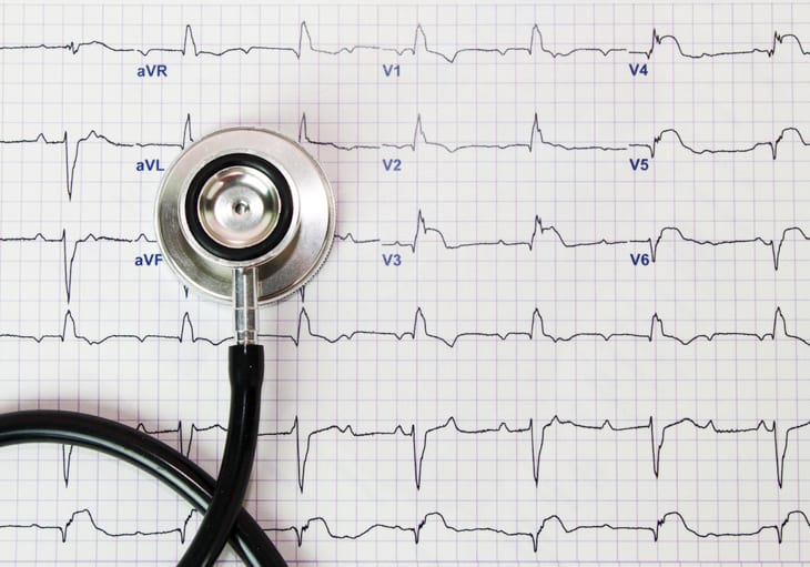 Outros fatores que interferem na qualidade do eletrocardiograma