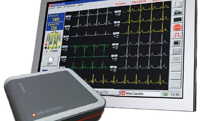 Cuidados-ao-manusear-um-Eletrocardiógrafo-Aparelho-de-eletrocardiograma usar um Eletrocardiógrafo