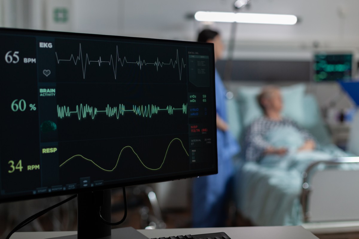 O resultado do eletrocardiograma pode vir como ECG normal ou alterado ECG de repouso