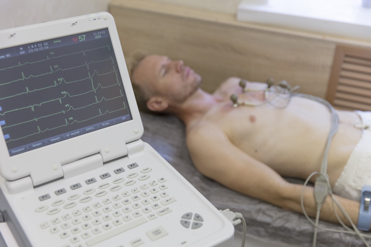 Exame ecg de repouso