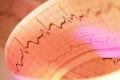 Telemedicina em Cardiologia telecardiologia com laudo ECG