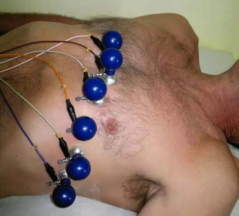 Eletrodos no tórax do paciente