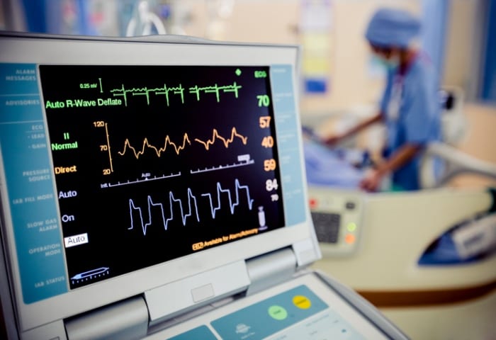 Qualidade do eletrocardiograma: o que define um bom exame de ECG?