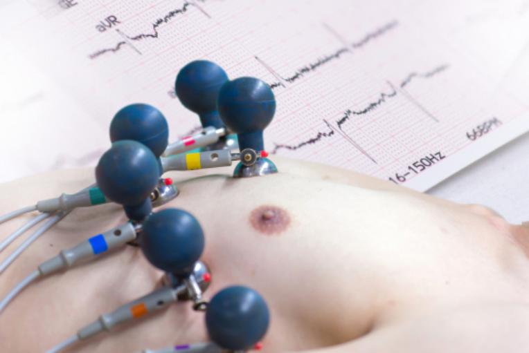 eletrocardiograma como é feito