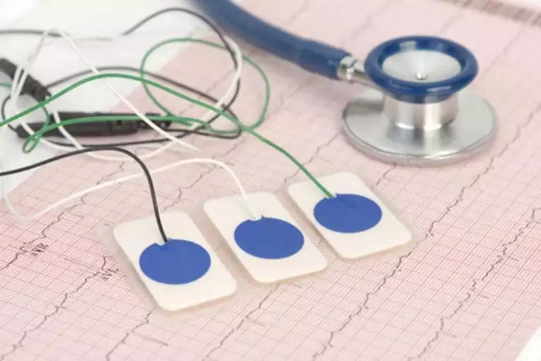 indicacao aparelhos como é feito o eletrocardiograma como funciona