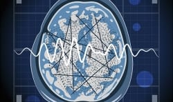 O que preciso saber sobre epilepsia?