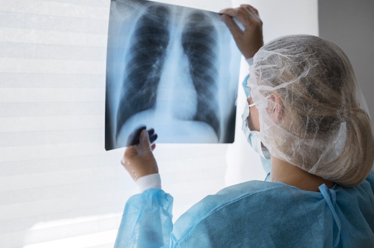 Pneumoconiose