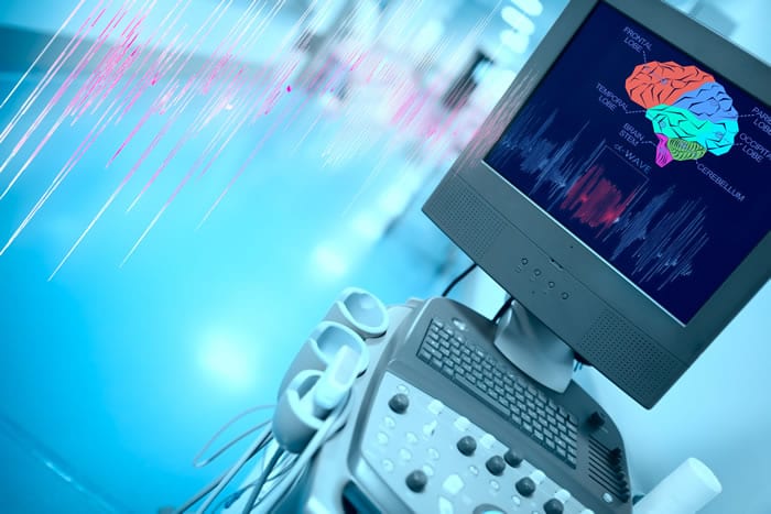 Benefícios do laudo a distância do EEG Ocupacional