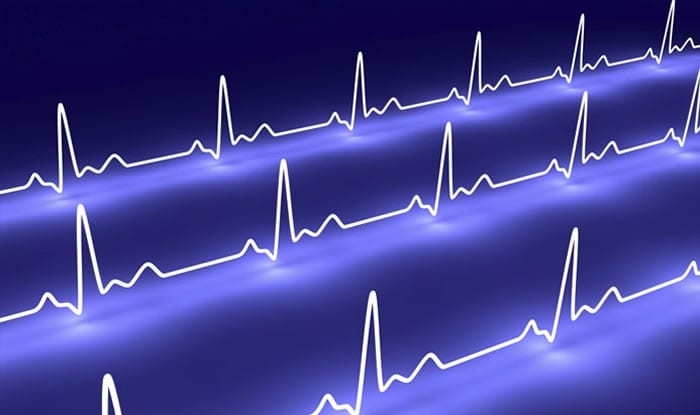 ecg online seguro