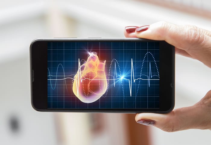 Por que oferecer o serviço de eletrocardiograma online na sua clínica?
