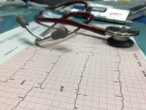 laudo eletrocardiograma a distancia na telemedicina eletrocardiograma a distância