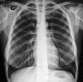 Telemedicina em Cardiologia telecardiologia com laudo ECG