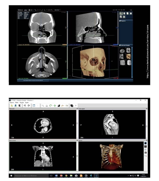 Imagens médicas em 3D