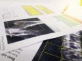 Telemedicina em Cardiologia telecardiologia com laudo ECG