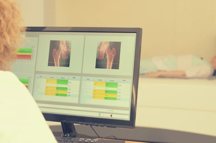 Como funciona o exame de densitometria óssea pela telemedicina