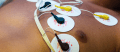 Telemedicina em Cardiologia telecardiologia com laudo ECG
