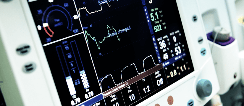 aluguel-de-eletrocardiograma-em-comodato aluguel de eletrocardiograma em comodato