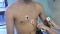 Telemedicina em Cardiologia telecardiologia com laudo ECG