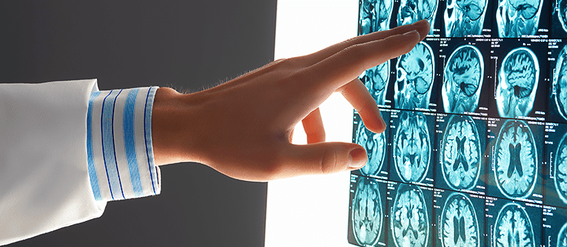 Telemedicina neurologia Teleneurologia