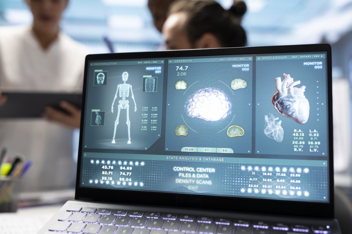 Inteligência artificial na saúde