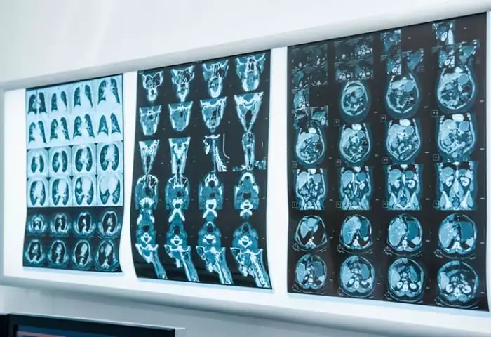 Características do laudo de tomografia com qualidade