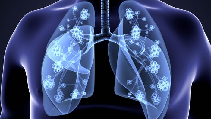 Riscos da Prova de Função Pulmonar