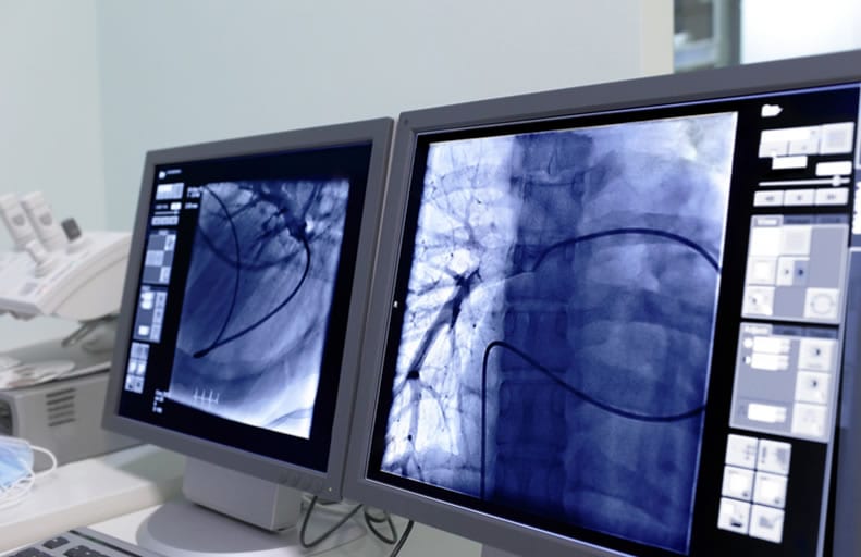 telerradiologia telerradiologia