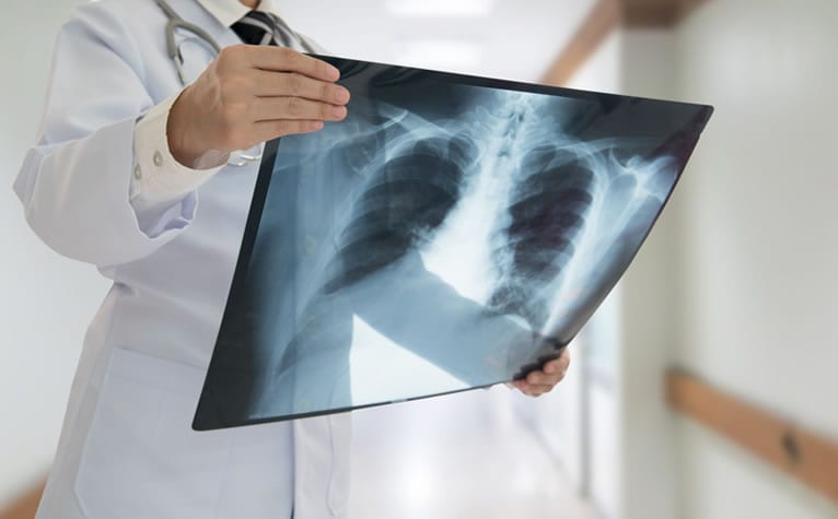Como funciona uma radiografia