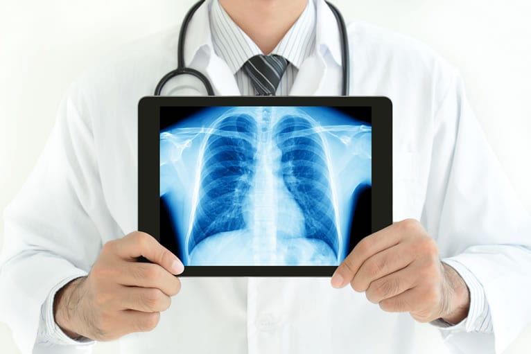 Benefícios RX digital nas clínicas