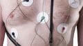 Telemedicina em Cardiologia telecardiologia com laudo ECG