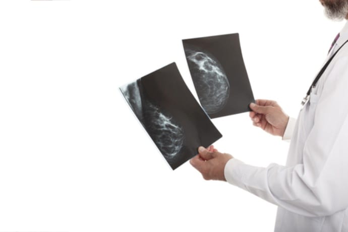 Como é realizado o laudo de mamografia na telemedicina?