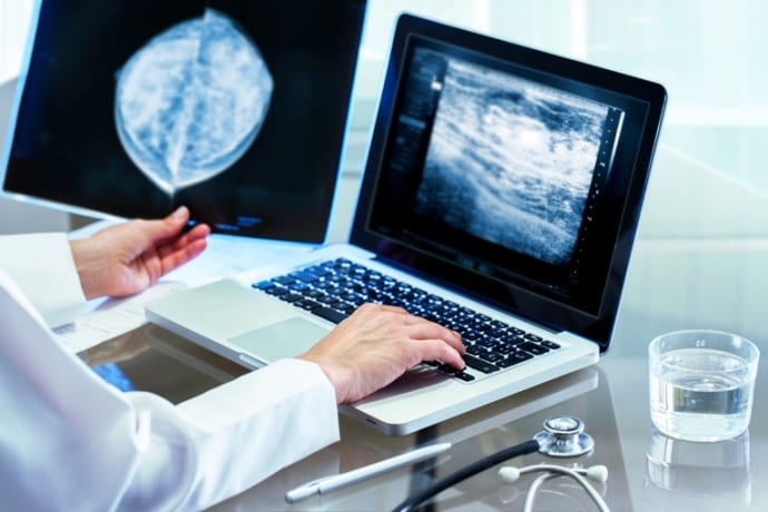 Importância do laudo de mamografia na saúde da mulher