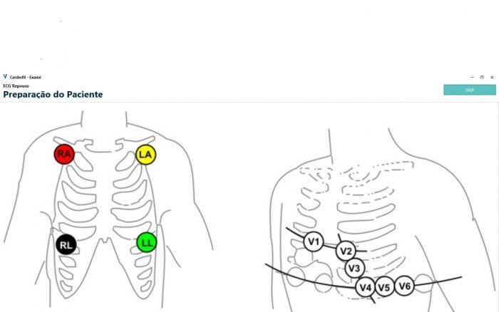 posicionamento-do-eletrodo-do-monitor-ecg-cardiovida