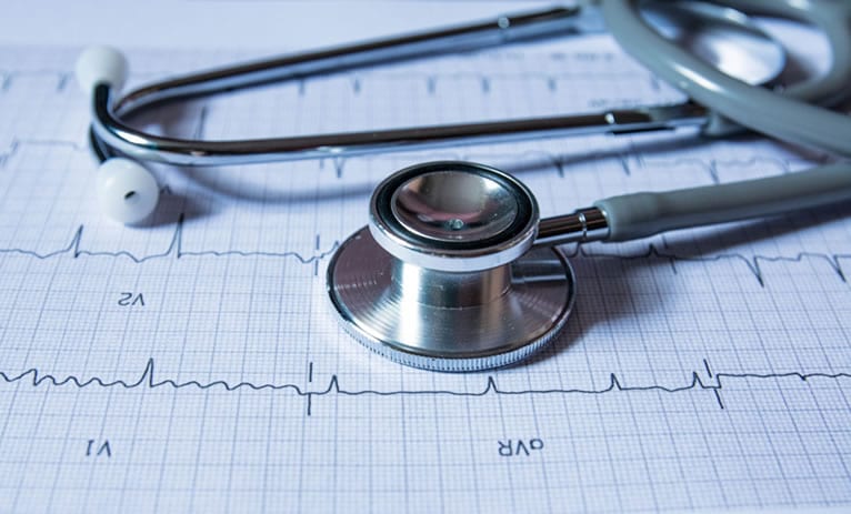 Contra-indicações e riscos ao realizar um eletrocardiograma