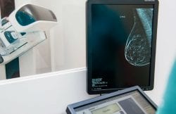 laudo rápido de mamografia