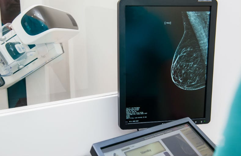 laudo rápido de mamografia laudo rápido de mamografia