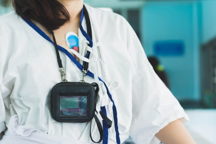 Como funciona o eletrocardiograma de longa duração?