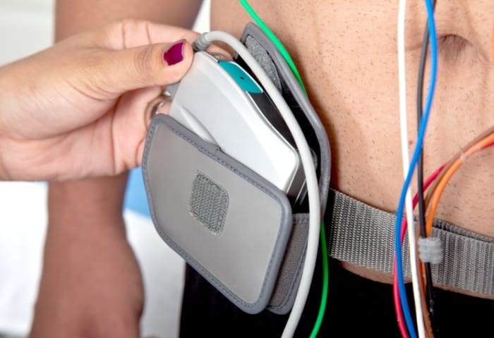 O que é eletrocardiograma de longa duração?