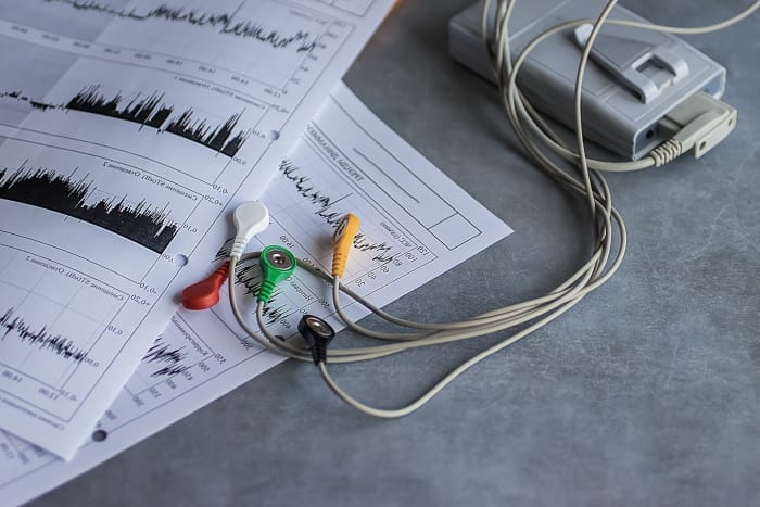 Quais os benefícios para uma clínica escolher o comodato de Holter?
