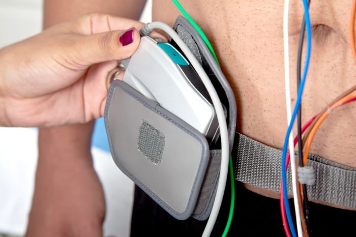 O que é comodato de Holter?