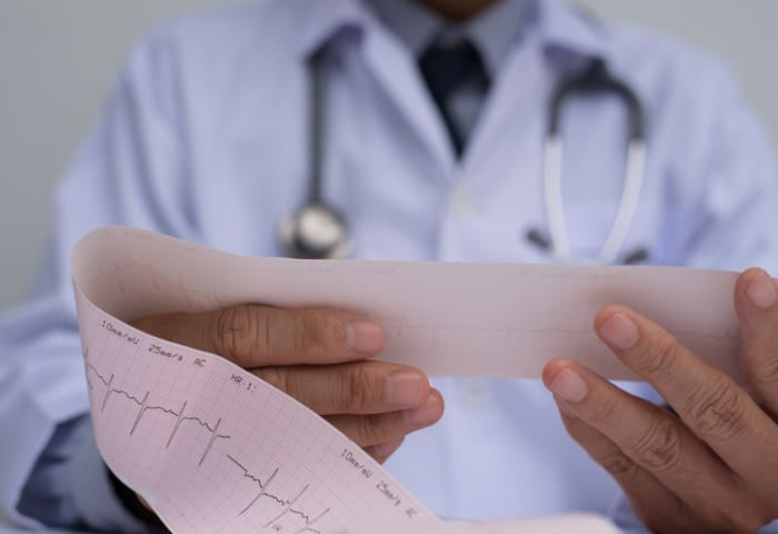 Vale a pena o comodato do eletrocardiograma digital?