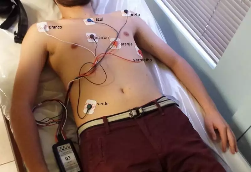 Holter de ecg Paciente deitado numa maca onde estão sendo colocados os eletrodos de holter no peito e gravador na cintura
