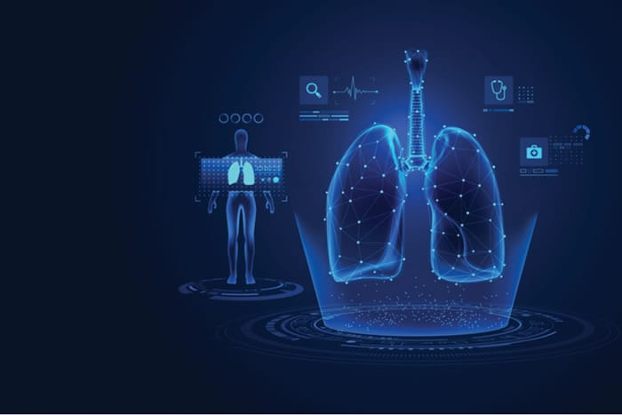 Telepneumologia como solução na emissão de laudo de espirometria ocupacional